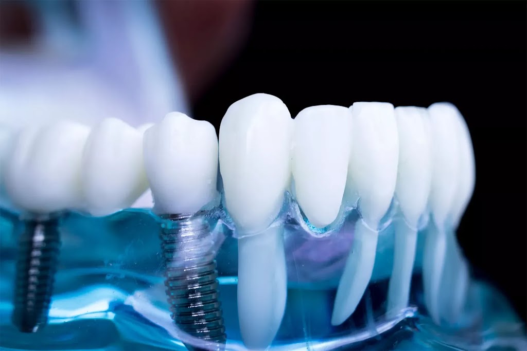 Affordable Dental Implants Albany | 816 Central Ave, Albany, NY 12206, USA | Phone: (518) 401-0900