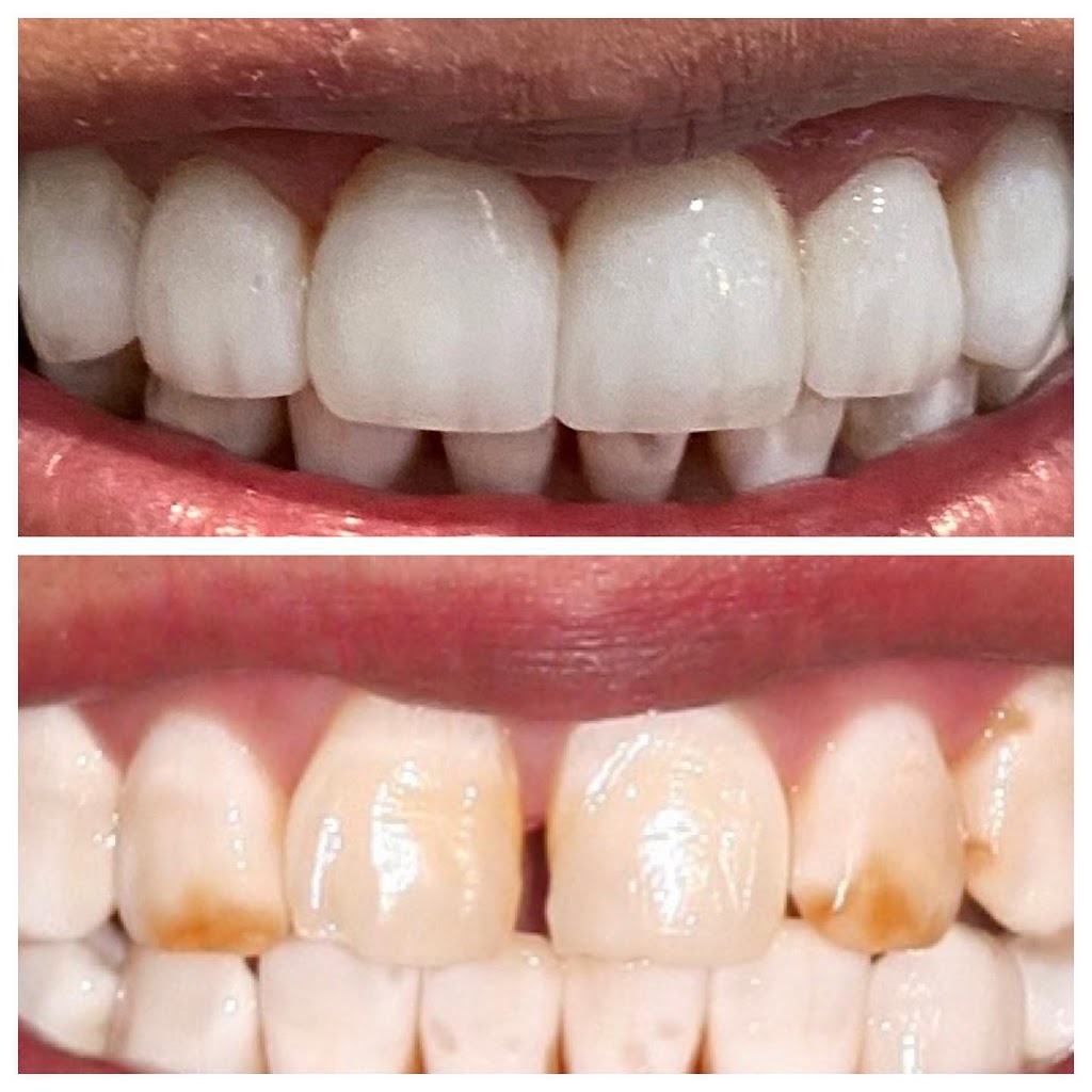 All Smiles Dental Care - Phoenix | 4726 E Thomas Rd, Phoenix, AZ 85018, USA | Phone: (602) 960-9130