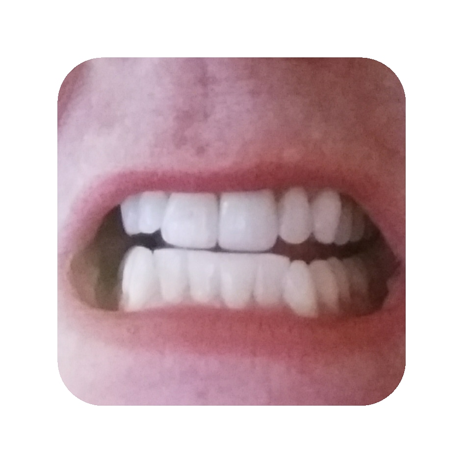 Malibu Teeth Whitening, Inc | 2103 E Parham Rd #204, Henrico, VA 23228, USA | Phone: (804) 629-3390