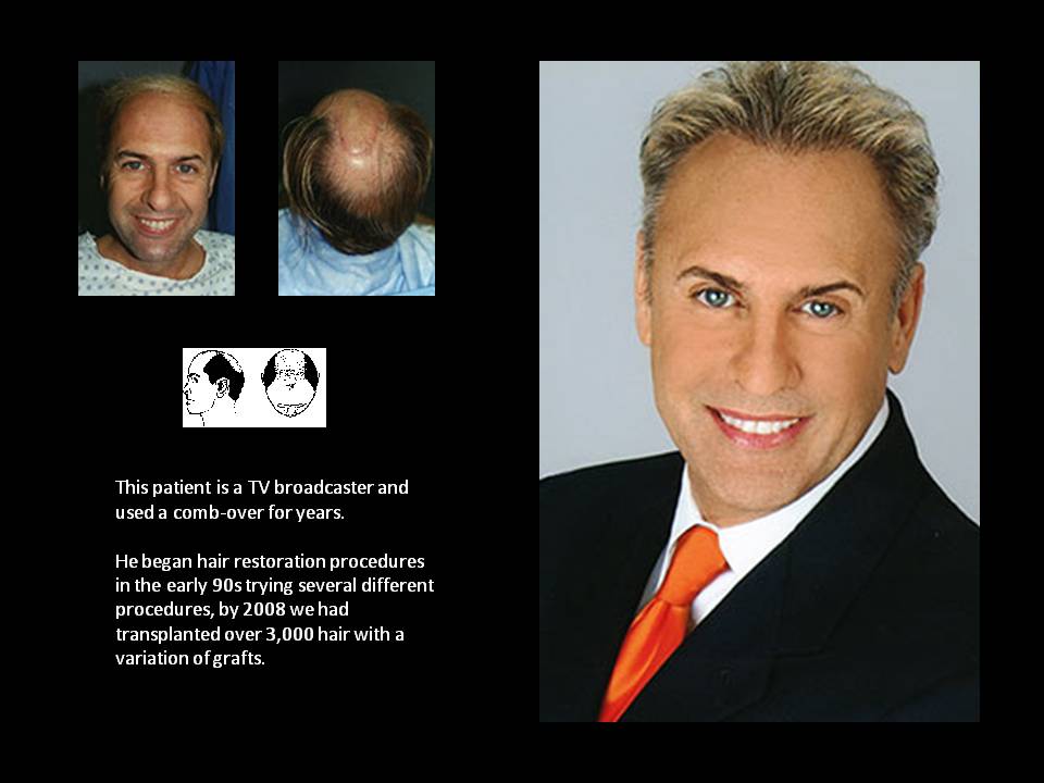 International Hair Surgical Group (IHSG) | 1150 Amboy Ave, Edison, NJ 08837, USA | Phone: (908) 222-0700