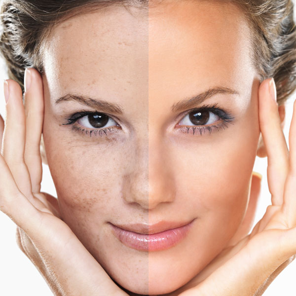 AZ Laser Studio & Medspa | 1061 N Dobson Rd #108, Mesa, AZ 85201, USA | Phone: (480) 450-4809