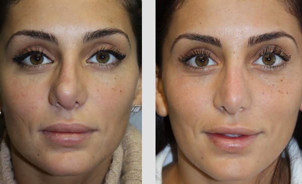 Zuliani Facial Aesthetics: Dr. Giancarlo F. Zuliani, MD | 50 W Big Beaver Rd # 280, Bloomfield Hills, MI 48304, USA | Phone: (248) 322-3362