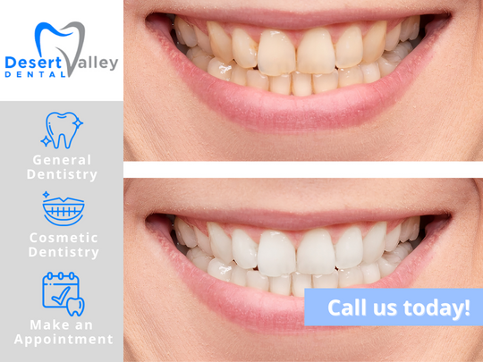 Desert Valley Dental | 5295 Sun Valley Blvd #6, Sun Valley, NV 89433, USA | Phone: (775) 673-1055