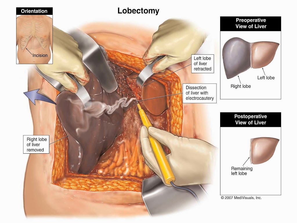 AZ TRANSPLANT ASSOCIATES | 2218 N 3rd St Ac, Phoenix, AZ 85004, USA | Phone: (602) 252-2543