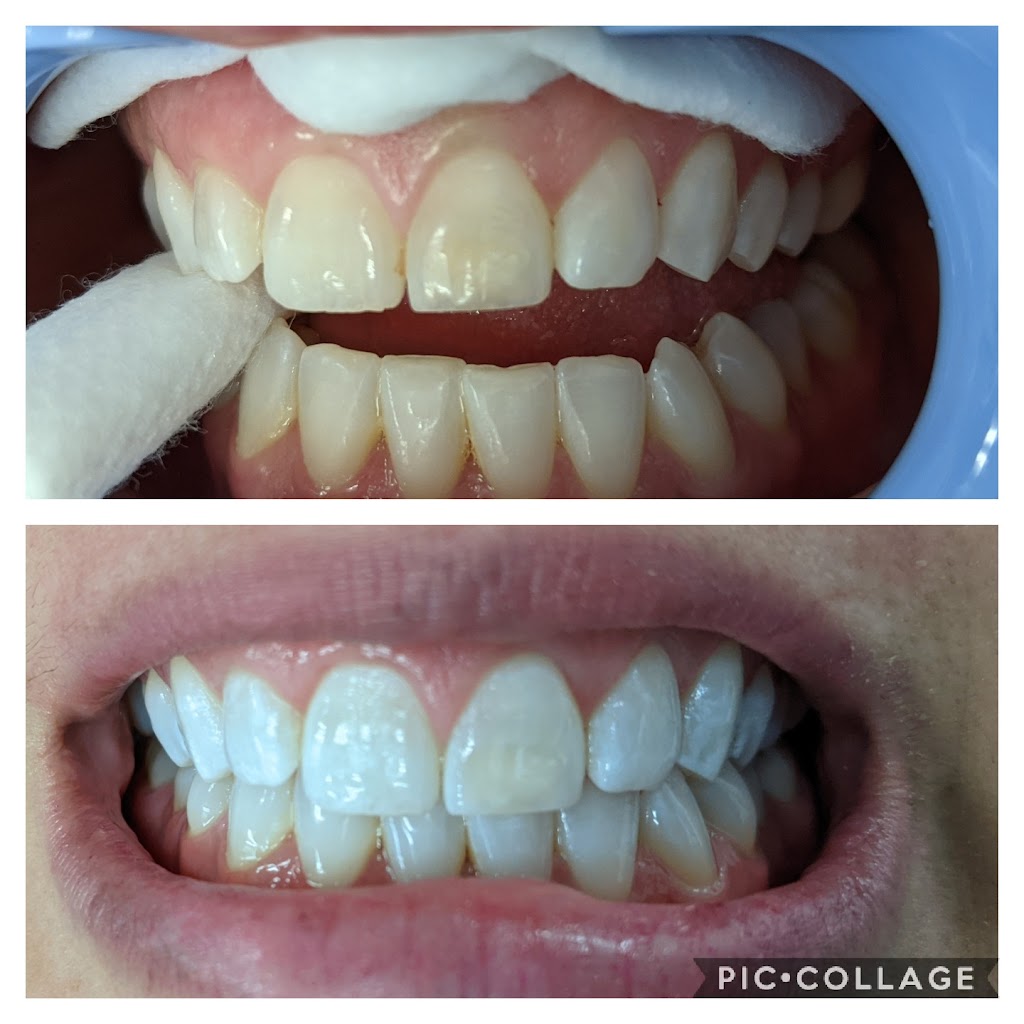 Teeth Whitening by Da Vinci | 2655 W Guadalupe Rd #8, Mesa, AZ 85202, USA | Phone: (480) 807-0002