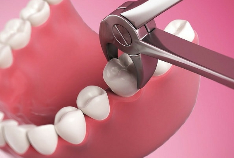 Bond Dental Group | 3845 La Sierra Ave STE 101B, Riverside, CA 92505 | Phone: (951) 359-7544