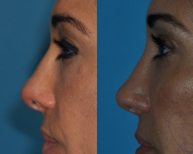 Totonchi Plastic Surgery | 38 Main St #300, Westlake, OH 44145, USA | Phone: (216) 778-2262