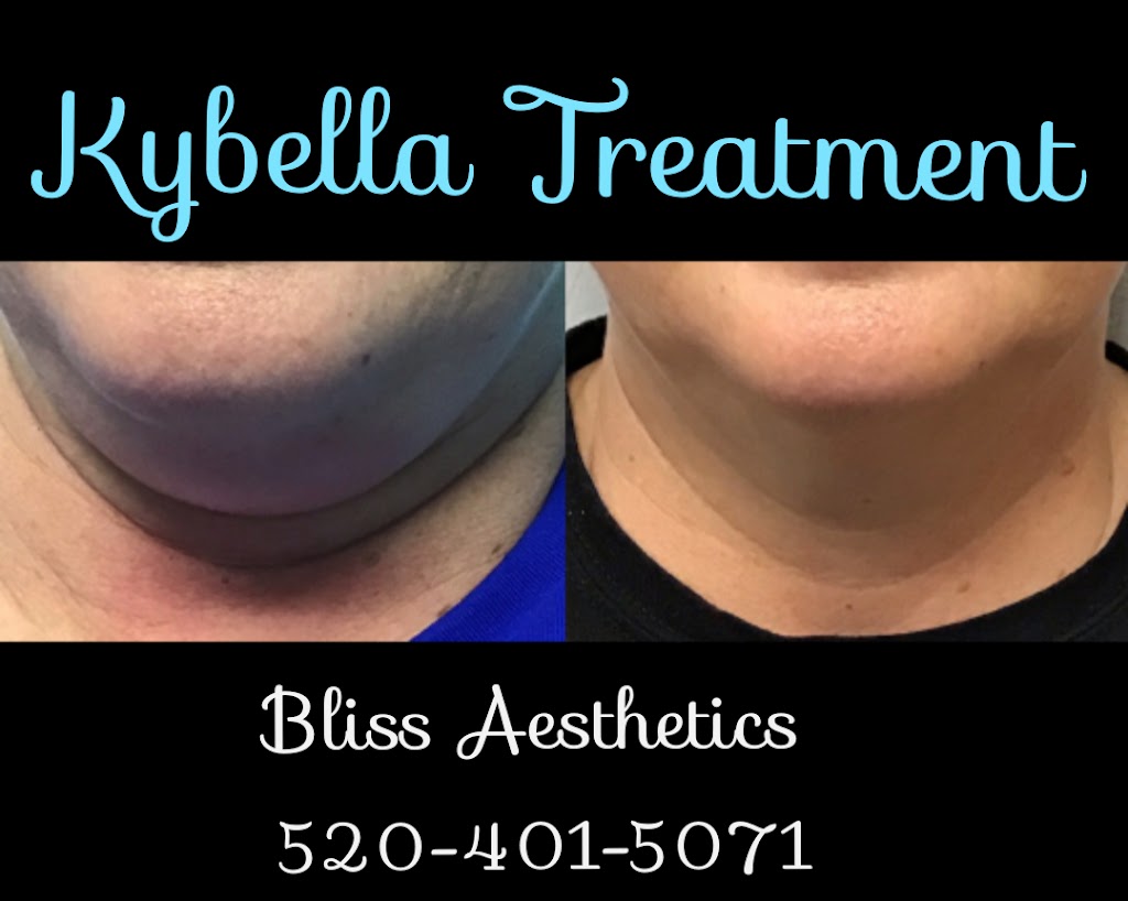 Beautiful Bliss Aesthetics | 7478 N La Cholla Blvd, Tucson, AZ 85741, USA | Phone: (520) 317-2555