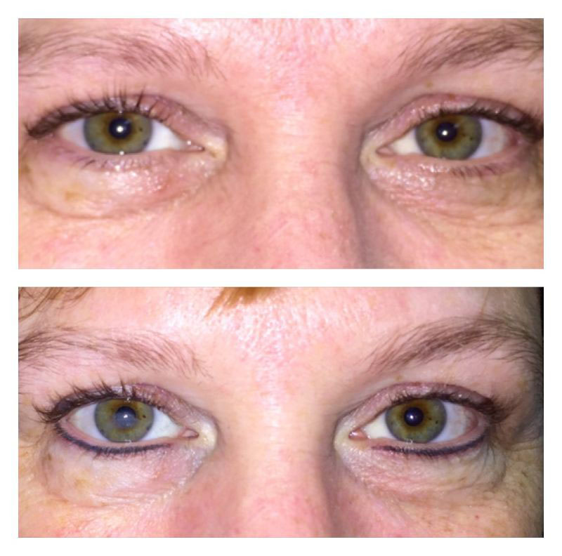 Cariangels Medi Spa (Total Laser, Spa & Skincare) | 455 Central Park Ave #212, Scarsdale, NY 10583, USA | Phone: (914) 337-0777 Cariangels Medi Spa (Total Laser, Spa & Skincare) | 455 Central Park Ave #212, Scarsdale, NY 10583, USA | Phone: (914) 337-0777