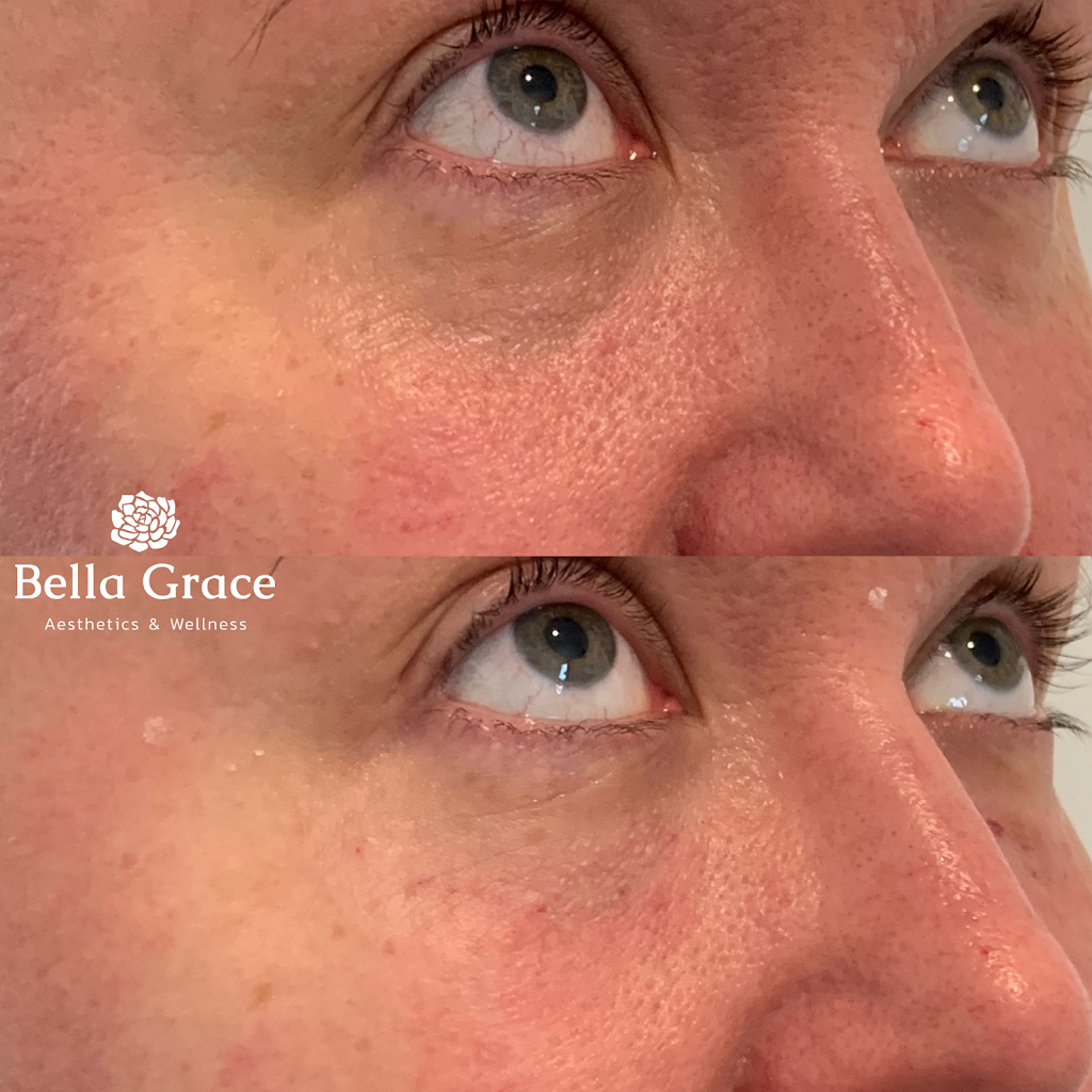 Bella Grace Aesthetics & Wellness, PLLC | 14101 West Hwy 290 Ste 300 Inside Blushing, Belle Beauty Bar, Austin, TX 78737 | Phone: (512) 270-1249