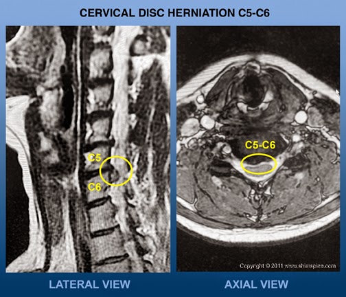 Shim Spine: John H. Shim, M.D. | 309 State St E APT 201, Oldsmar, FL 34677, USA | Phone: (813) 814-9251