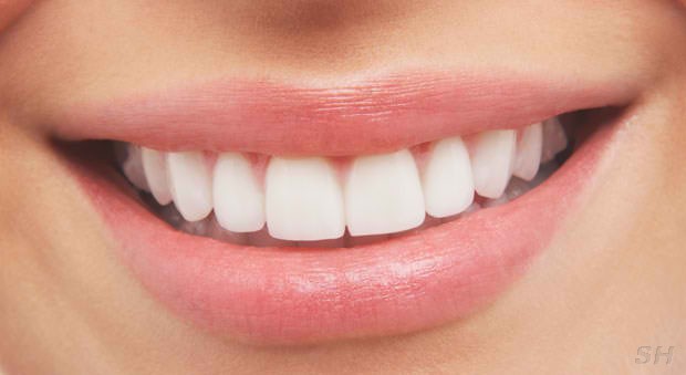 Hollywood Smile Dental | 97-50 Queens Blvd, Rego Park, NY 11374 | Phone: (718) 830-0110