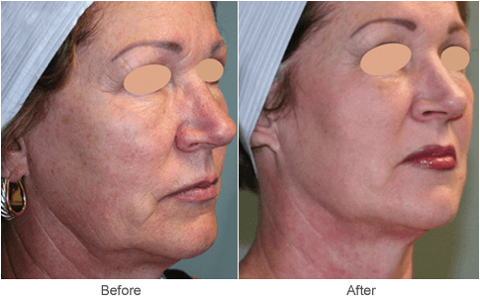 Ageless Beauty Skincare Clinic | 44121 Harry Byrd Hwy STE 285, Ashburn, VA 20147, USA | Phone: (571) 352-9294