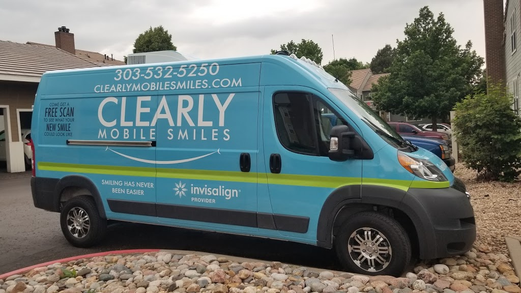 Clearly Mobile Smiles | 2750 W 29th Ave, Denver, CO 80211, USA | Phone: (303) 532-5250