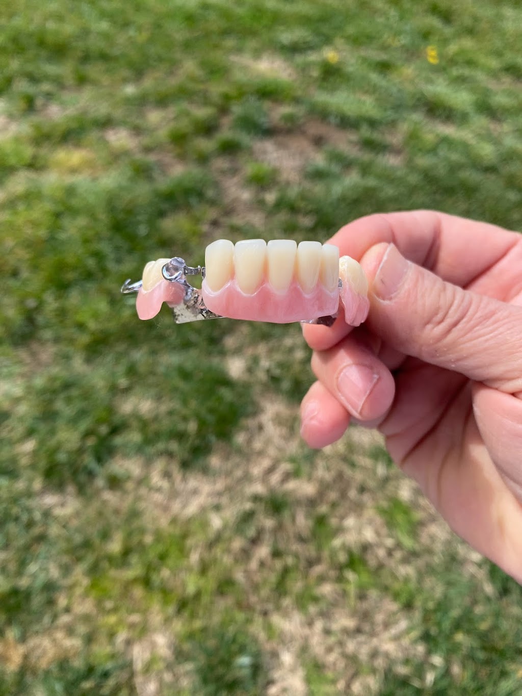 Martigon Dental Lab | 12684 Atherton Dr, Moreno Valley, CA 92555, USA | Phone: (951) 247-3459