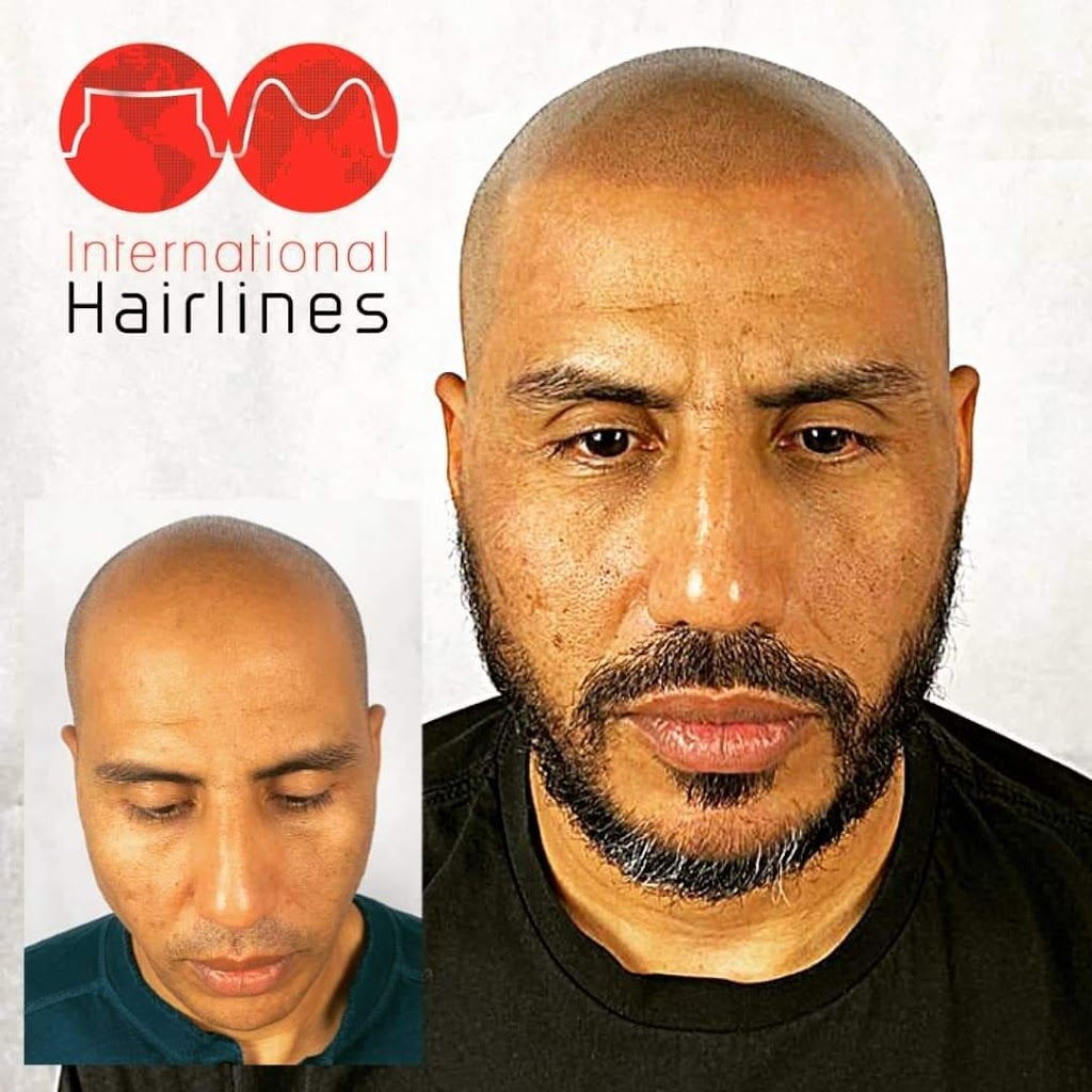 Pittsburgh International Hairlines | 2001 Montour Church Rd Second Floor, Oakdale, PA 15071, USA | Phone: (877) 567-3709