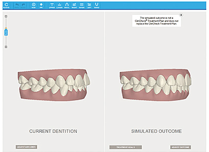 Castella Orthodontics | 1226 Essex County Rd 22 #102, Emeryville, ON N0R 1C0, Canada | Phone: (519) 979-5500