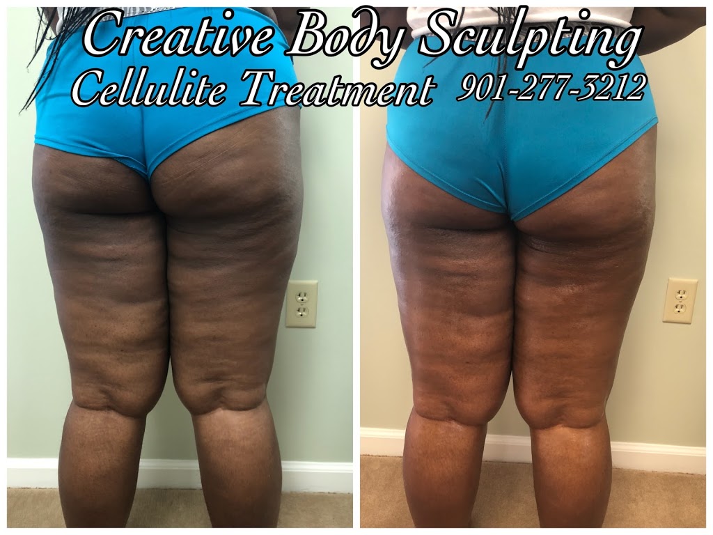 Creative Body Sculpting, LLC | 855 Willow Tree Cir Suite 202, Cordova, TN 38018, USA | Phone: (901) 277-3212