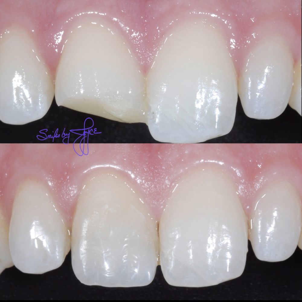 Bassett Joyce DDS | 3697, 14275 N 87th St # 215, Scottsdale, AZ 85260, USA | Phone: (480) 367-8889