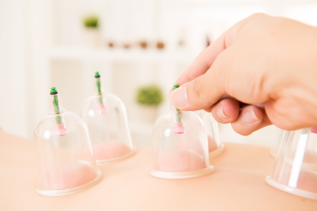 Minnesota Hijama Therapy (Cupping) | 7260 University Ave NE #300, Fridley, MN 55432, USA | Phone: (763) 213-7574