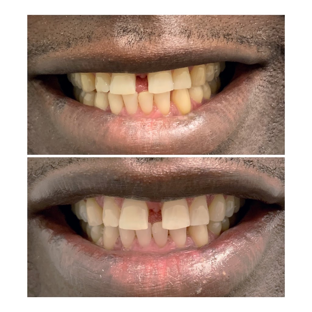 Smile Spa Teeth Whitening | 143 E Germann Rd building 101 suite 404, Gilbert, AZ 85297, USA | Phone: (480) 925-4050