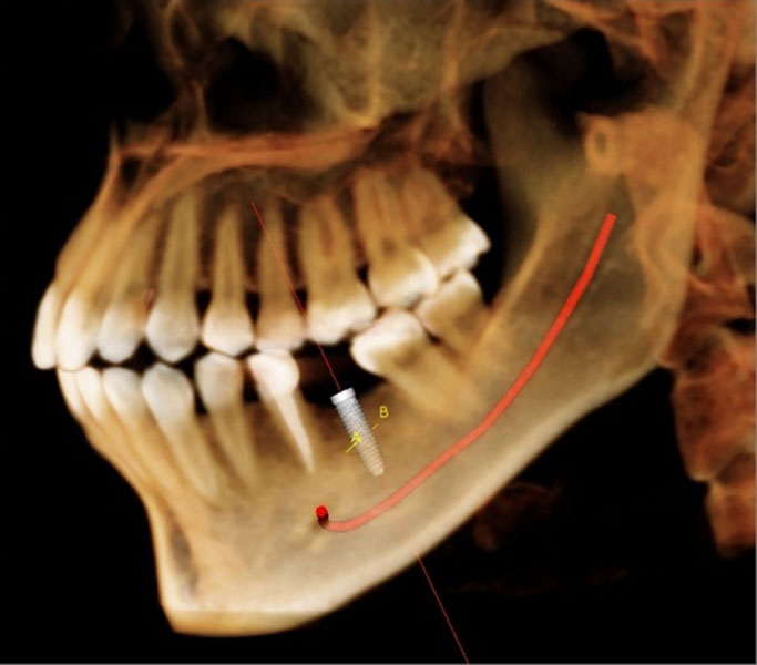 Capital Dental Equipment | 2001 Windy Terrace, Cedar Park, TX 78613, USA | Phone: (888) 759-4287