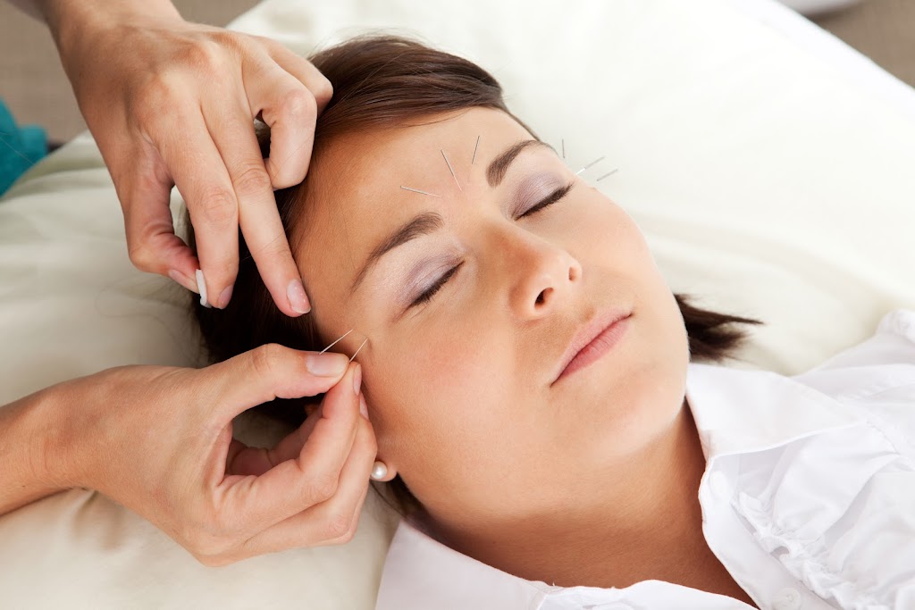 Hudson River Acupuncture | 1363 NY-9G, Hyde Park, NY 12538, USA | Phone: (845) 233-5445