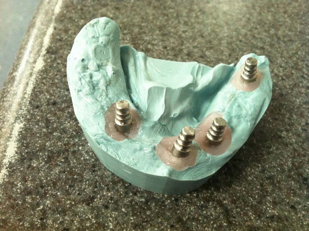 Precision Dental Prosthetics | 23021 N 15th Ave #205, Phoenix, AZ 85027, USA | Phone: (602) 485-7845