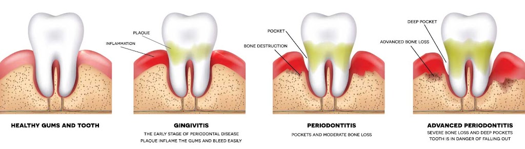 Robert Jones D.D.S. | 2200 E Fruit St Ste 208, Santa Ana, CA 92701, USA | Phone: (714) 543-2636