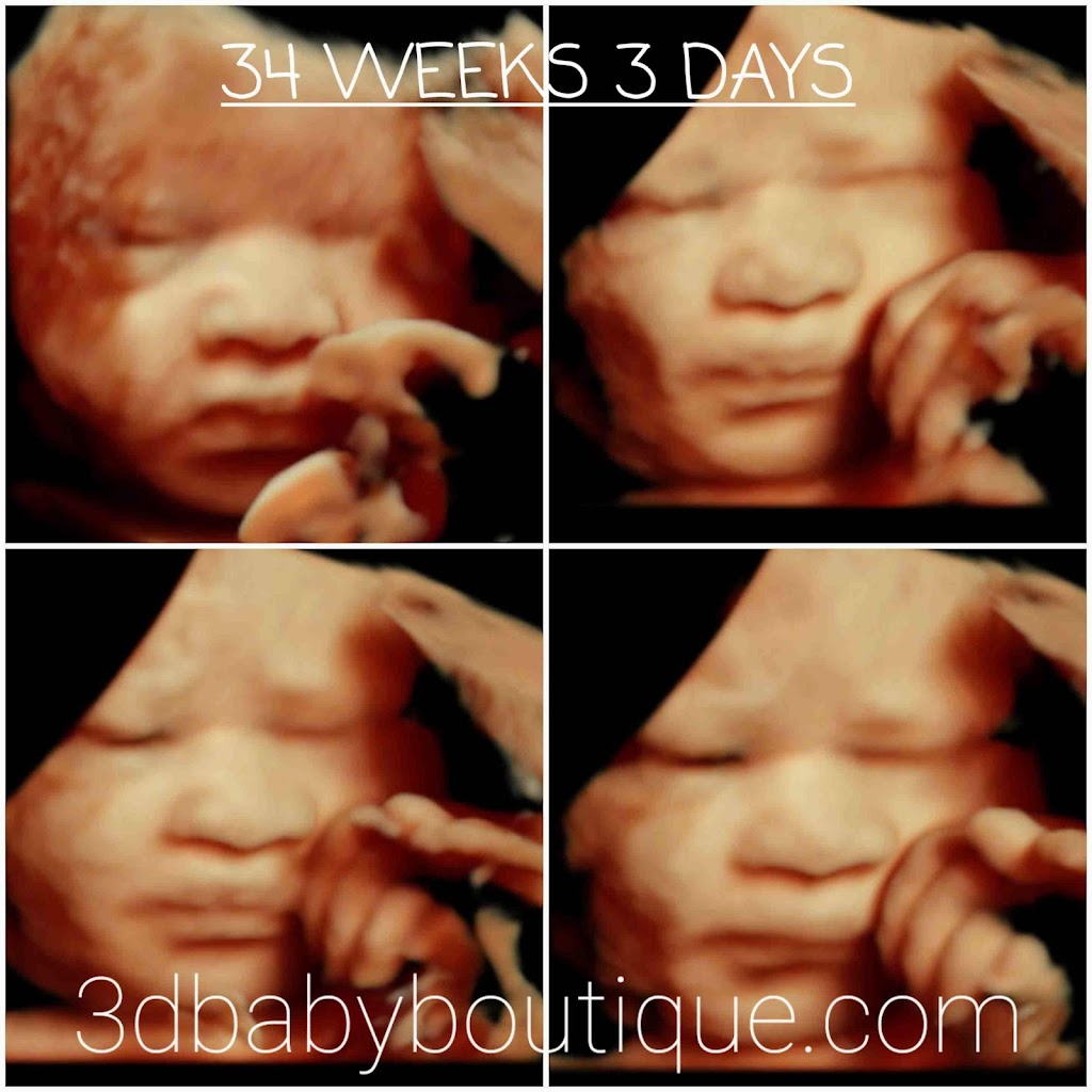 3D Baby Boutique 5D HD Ultrasound | 5600 W Maple Rd Suite B-206, West Bloomfield Township, MI 48322, USA | Phone: (248) 965-9557