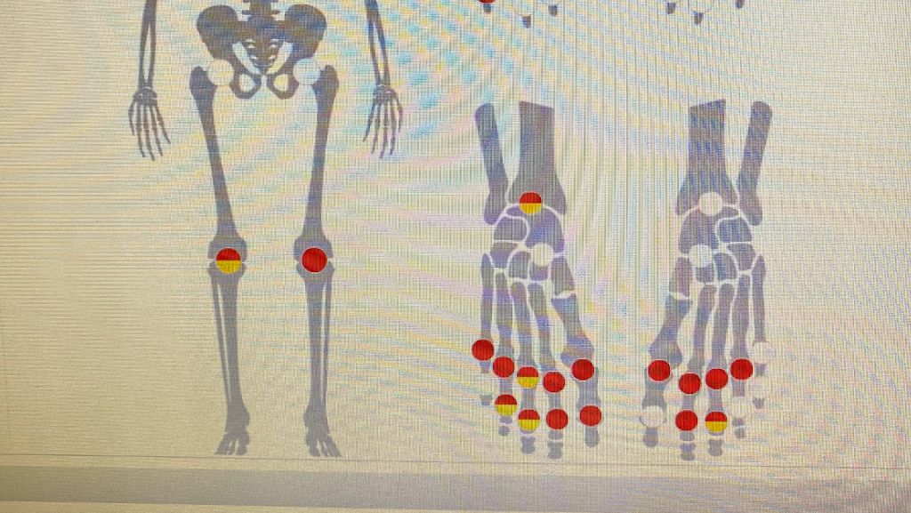 SouthWest Rheumatology Research, LLC | 1600 Republic Pkwy Suite #200, Mesquite, TX 75150, USA | Phone: (972) 288-2600