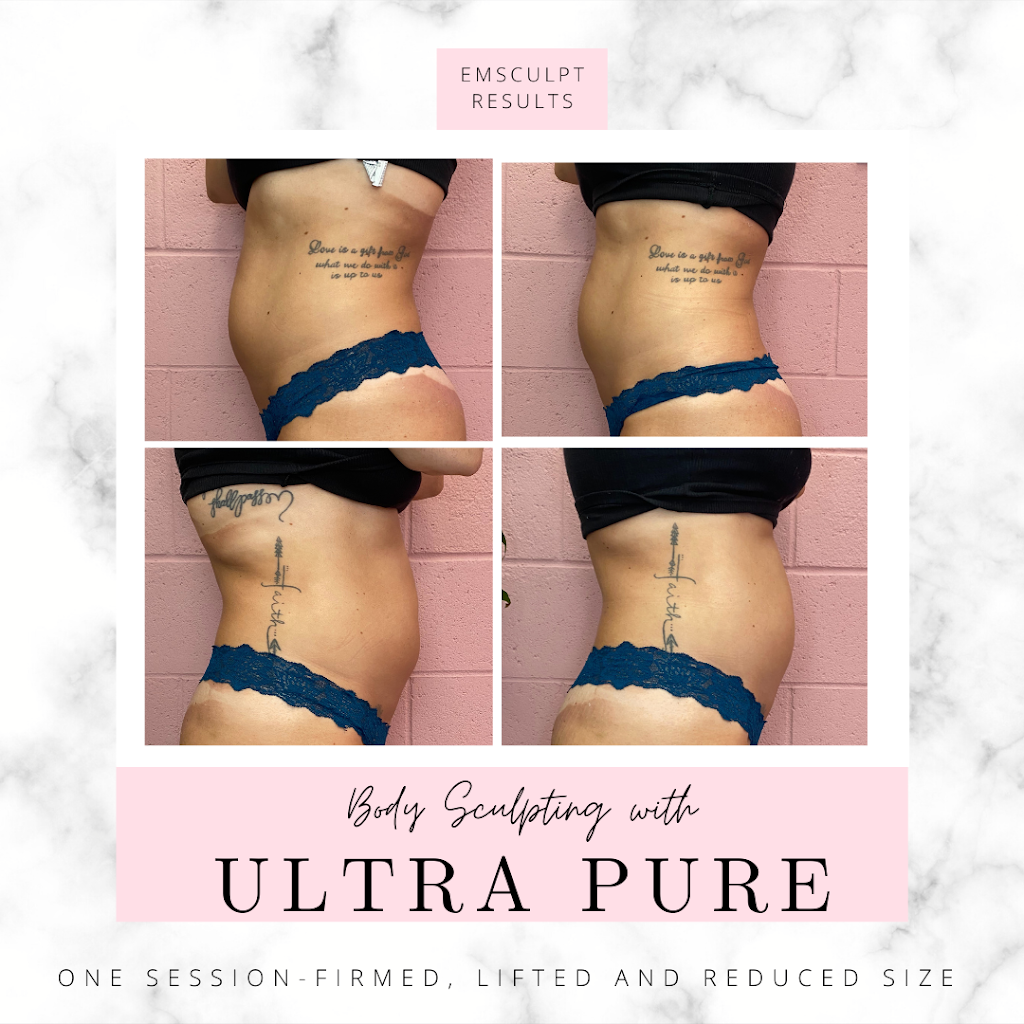 Ultra Pure Aesthetics | 136 E St Joseph St Suite D, Arcadia, CA 91006, USA | Phone: (626) 428-5836