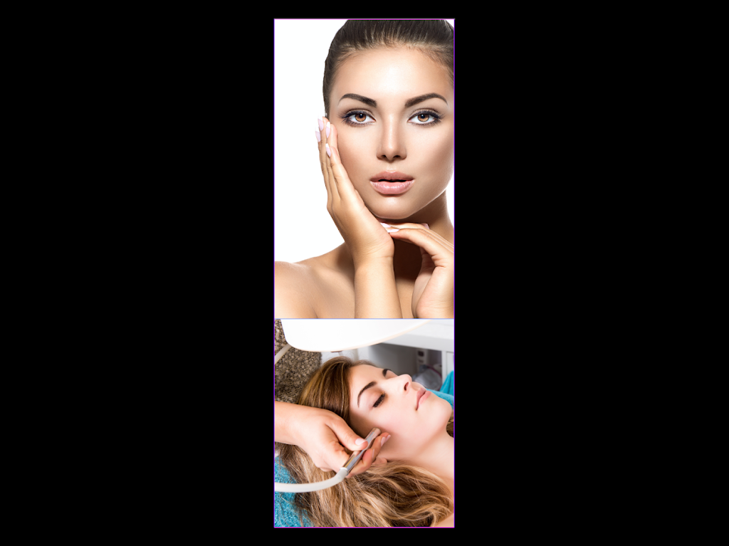 Angel’s Aesthetics | 9908 Las Tunas Dr suite J, Temple City, CA 91780, USA | Phone: (626) 636-6373