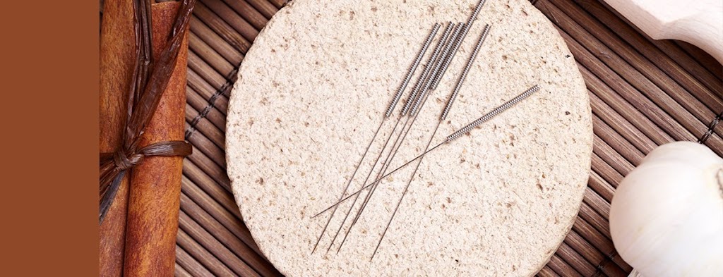 DH Acupuncture: Donghwan Lee, LAc | 133 E 58th St #710, New York, NY 10022, USA | Phone: (917) 881-9304