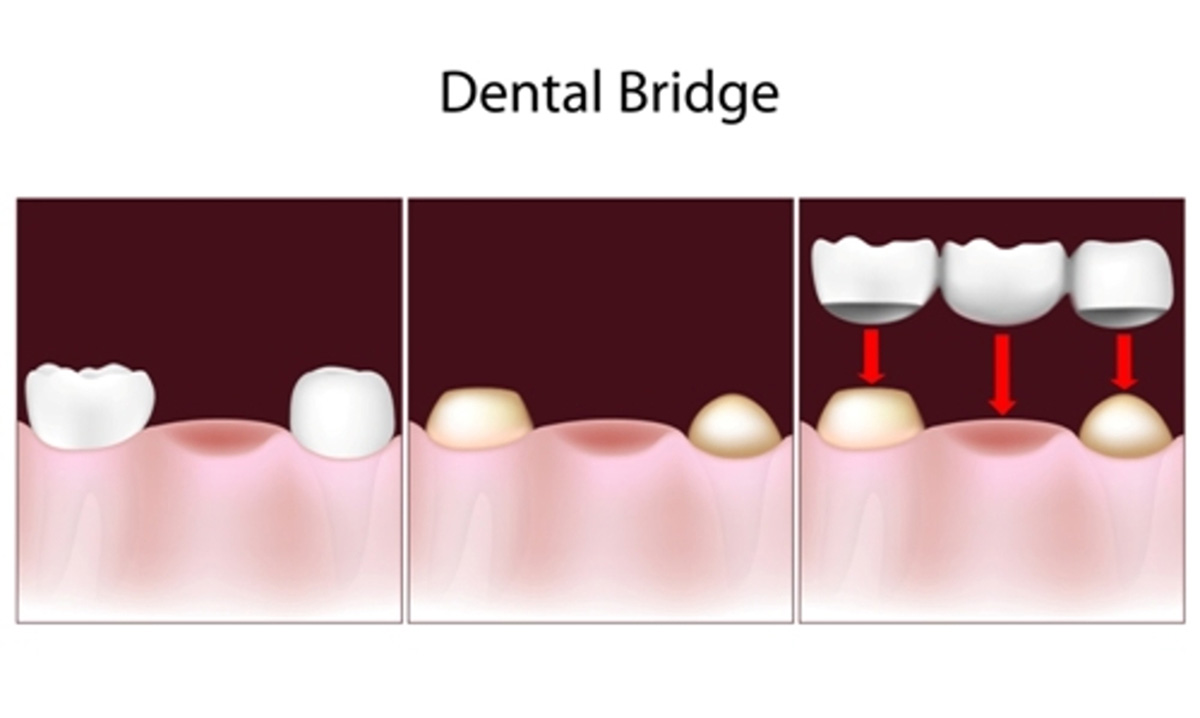 Imagine Dental Group | 6482 Main St, Vancouver, BC V5W 2V4, Canada | Phone: (604) 800-7233