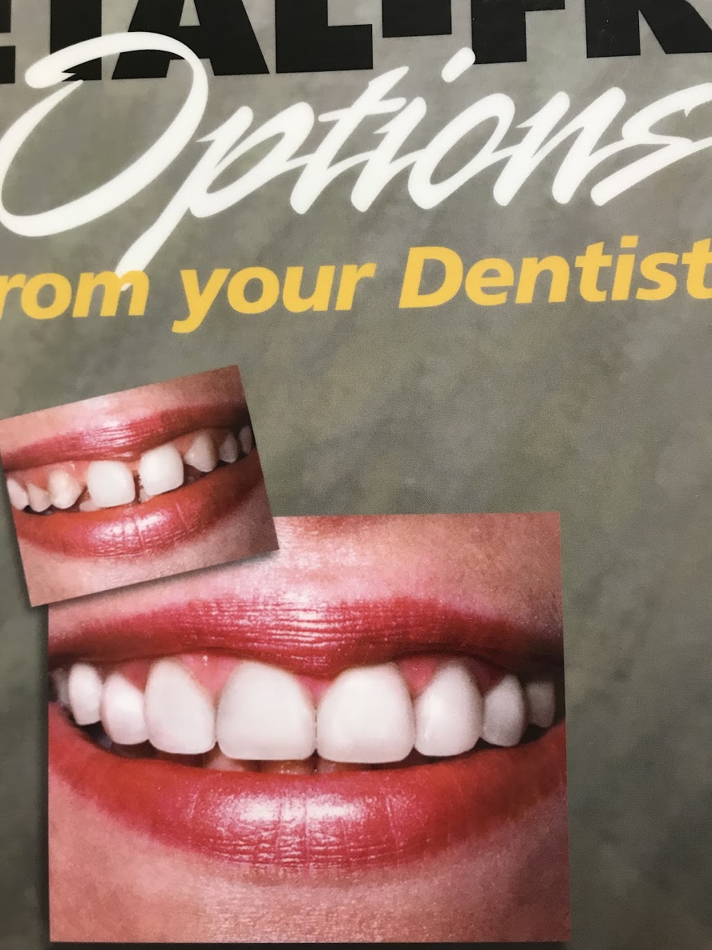 Dr. David Chou, DDS | 1206 N Hacienda Blvd, La Puente, CA 91744, USA | Phone: (626) 917-8630 Dr. David Chou, DDS | 1206 N Hacienda Blvd, La Puente, CA 91744, USA | Phone: (626) 917-8630
