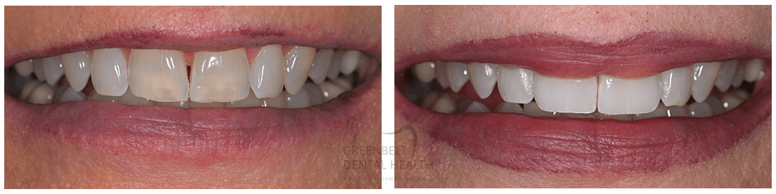 Greenbelt Dental Health | 1301 W 25th St #402, Austin, TX 78705, United States | Phone: (512) 472-3565