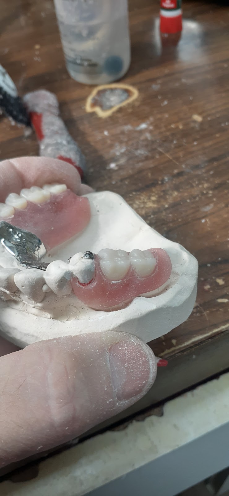 R&B Dental Lab | 21374 Ramona Ave, Apple Valley, CA 92307, USA | Phone: (760) 261-2425