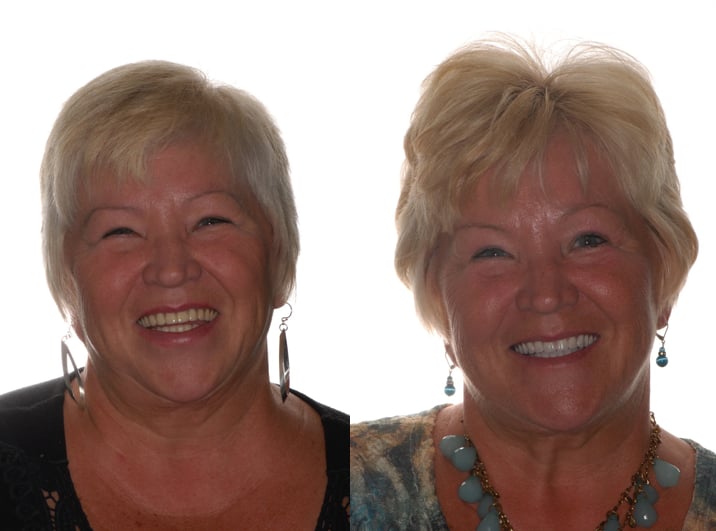 Jovan Prosthodontics | 4010 Sandy Brook Dr # 208, Round Rock, TX 78665, USA | Phone: (512) 716-1200