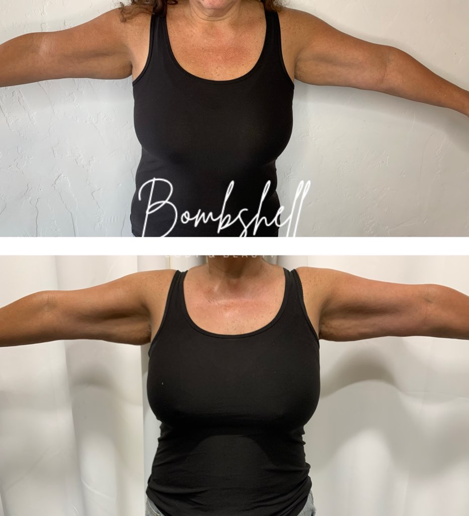 Bombshell Body & Beauty | 24619 Washington Ave, Murrieta, CA 92562, USA | Phone: (951) 797-7369