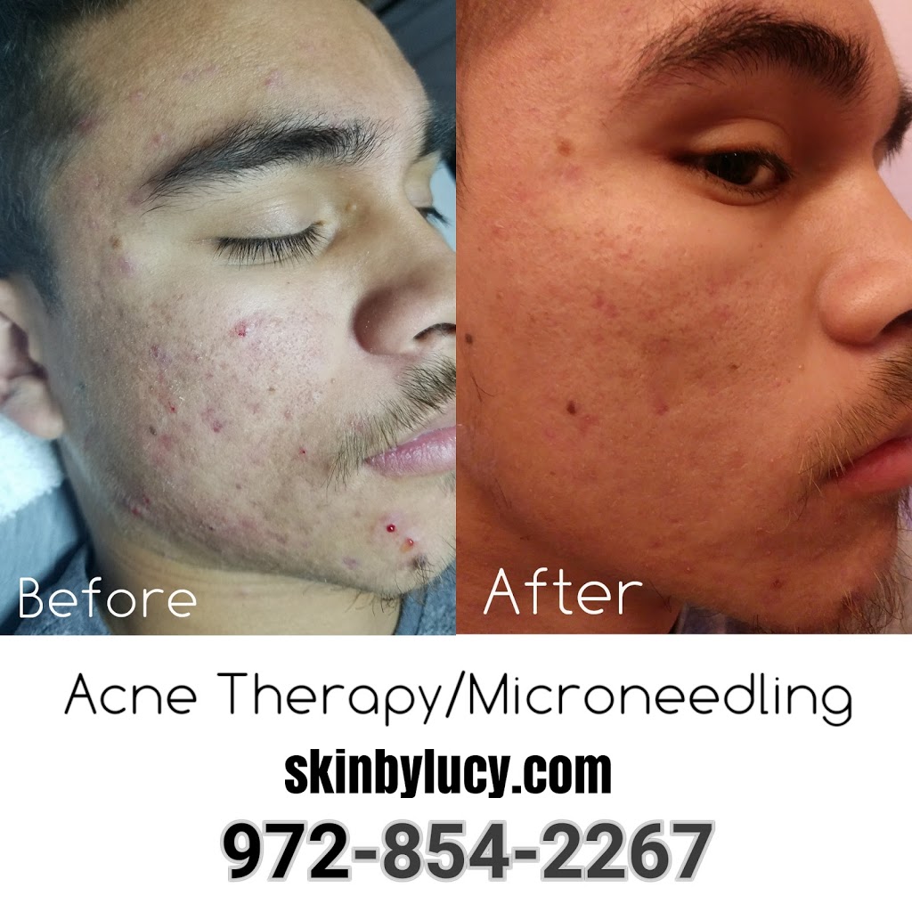 Skin By Lucy Med | 7000 Parkwood Blvd e100, Frisco, TX 75034, USA | Phone: (972) 854-2267