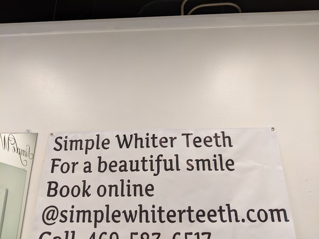 Simple Whiter Teeth | Forney, Tx. 75126. &, Wylie, TX 75098, USA | Phone: (214) 605-2494