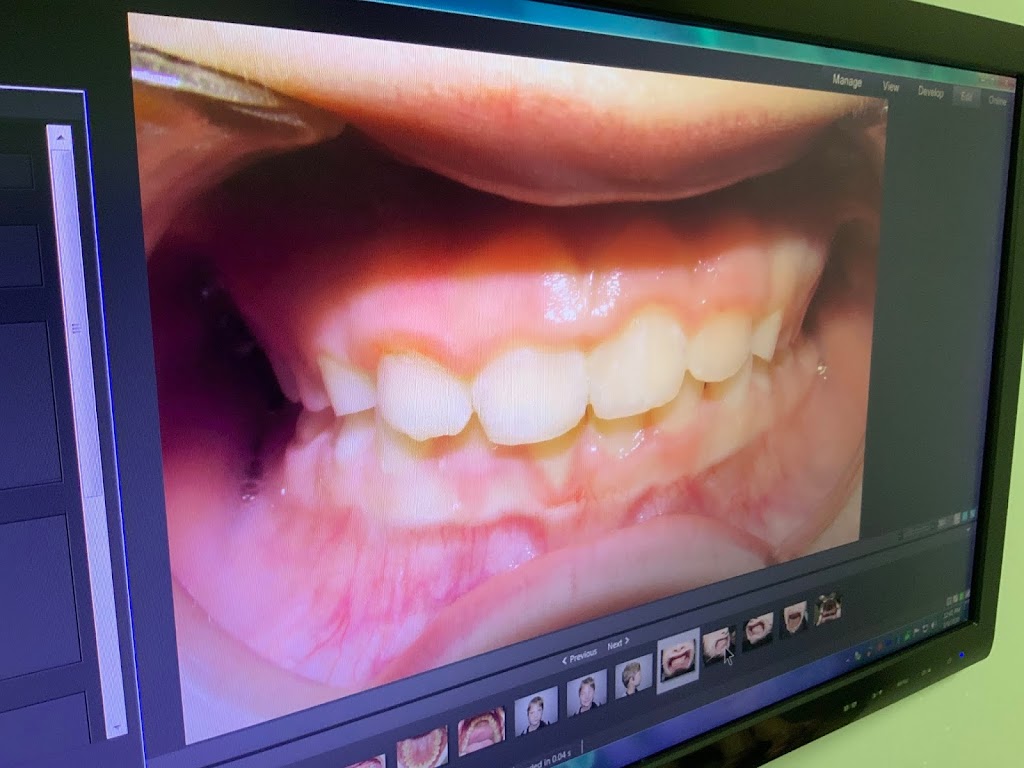 Happy Braces Orthodontics, La Mirada - dentist  | Photo 7 of 10 | Address: 12271 La Mirada Blvd #202, La Mirada, CA 90638, USA | Phone: (562) 944-8877