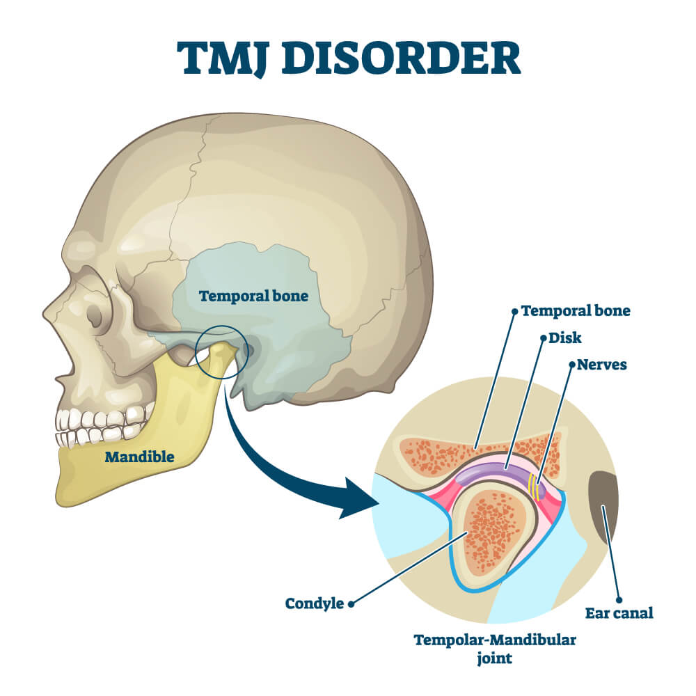 Center for Sleep and TMJ | 1301 Bridgeport Way Suite 109 B, Suffolk, VA 23435, United States | Phone: (757) 866-5884