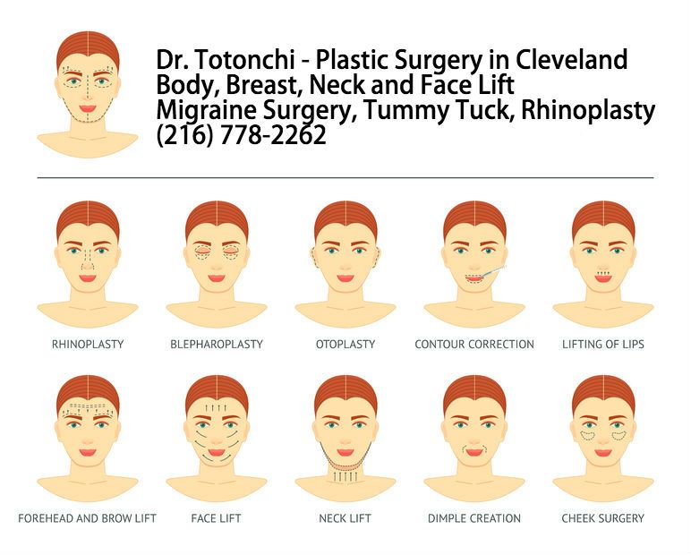 Totonchi Plastic Surgery | 29017 Cedar Rd, Lyndhurst, OH 44124, USA | Phone: (440) 461-7999