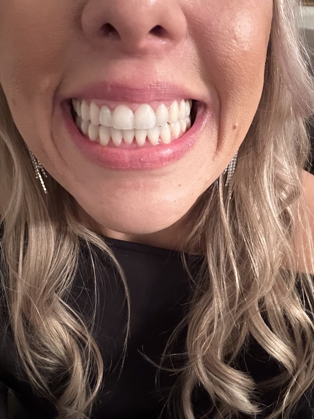 Dr. Bradley Porter, DDS | 6808 E Brown Rd, Mesa, AZ 85207, USA | Phone: (480) 830-5866