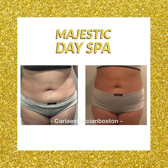 Majestic Day Spa | 1501 Main St STE 55, Tewksbury, MA 01876, USA | Phone: (603) 814-0529