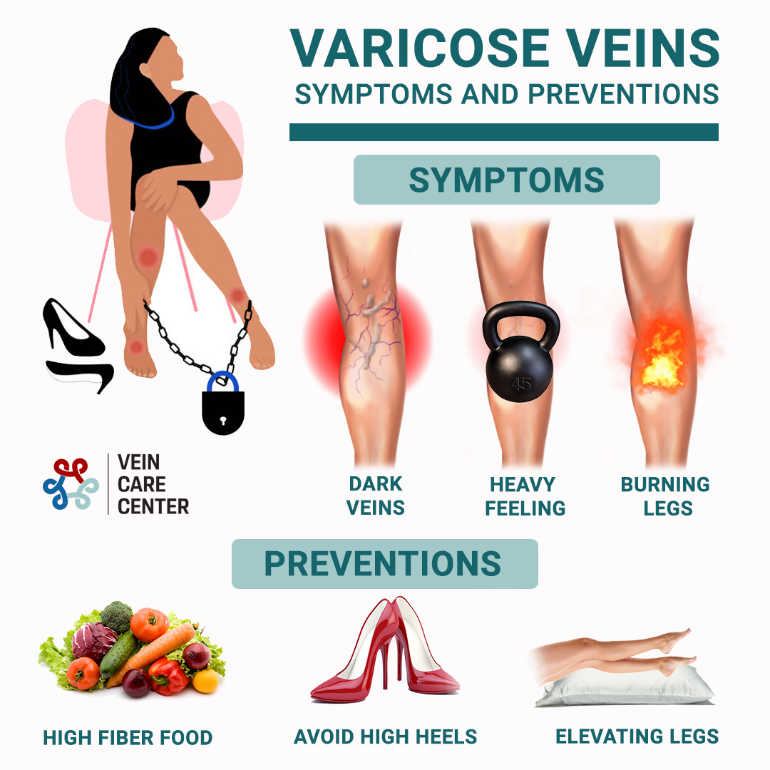 Vein Care Center | 41 5th Ave, 1ABV, New York, NY 10003, United States | Phone: (212) 242-8164