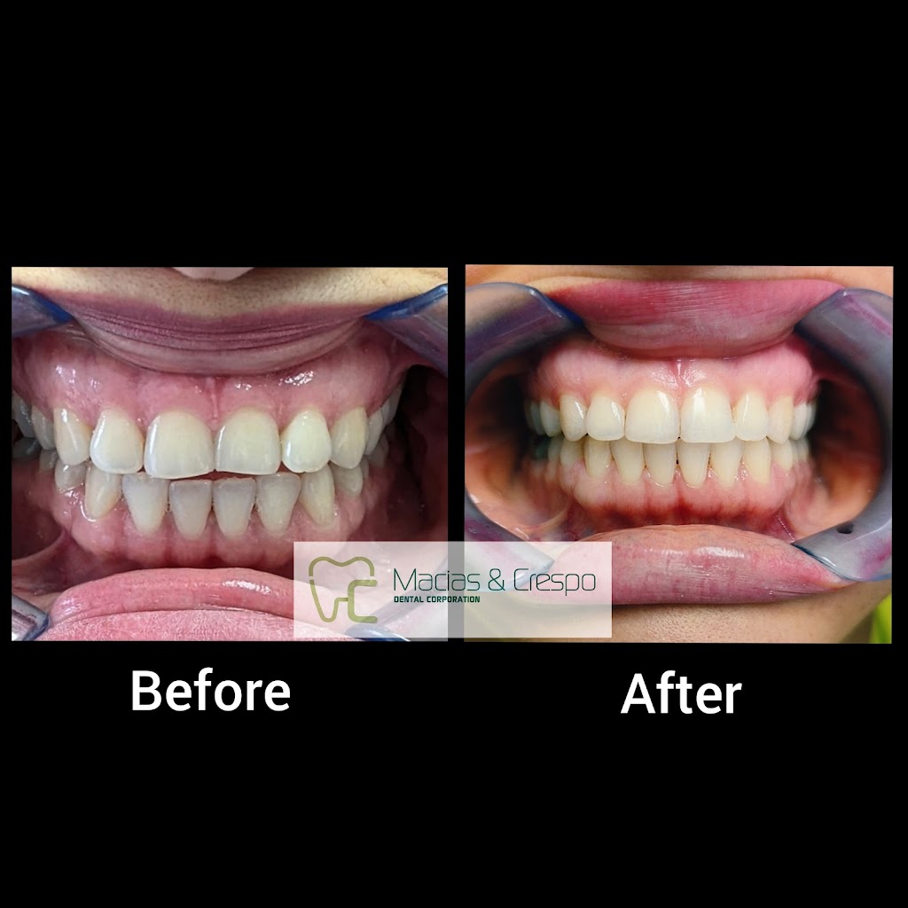 Crespo Dental Corp. | 2232 Rd 20, San Pablo, CA 94806, USA | Phone: (510) 236-5640