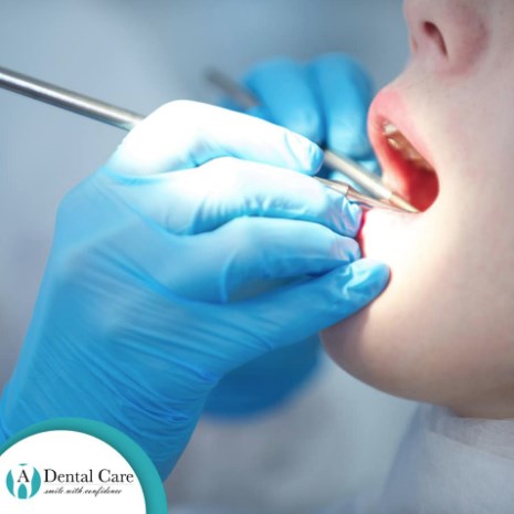 A Dental Care | 7312 Louetta Rd B119, Spring, TX 77379, United States | Phone: (832) 990-2866